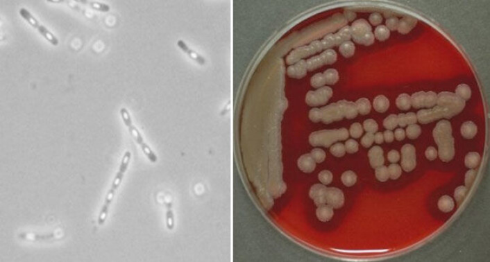 Bacillus cereus med sporer observert i mikroskop, og vekst på en blodagarskål (Foto: Per Einar Granum) Bacillus cereus med sporer observert i mikroskop, og vekst på en blodagarskål (Foto: Per Einar Granum)