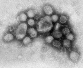 H1N1-viruset. Svineinfluensa. (Foto: Wikimedia Commons) H1N1-viruset. Svineinfluensa. (Foto: Wikimedia Commons)