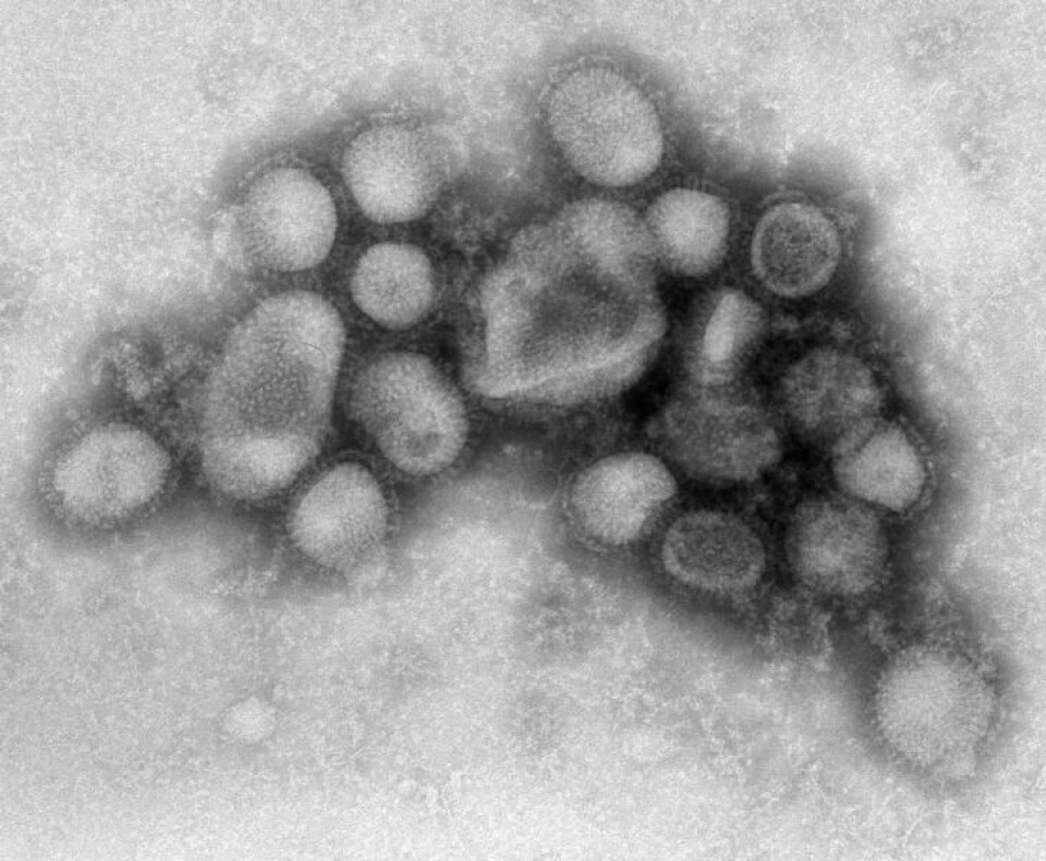 H1N1-viruset. Svineinfluensa. (Foto: Wikimedia Commons)