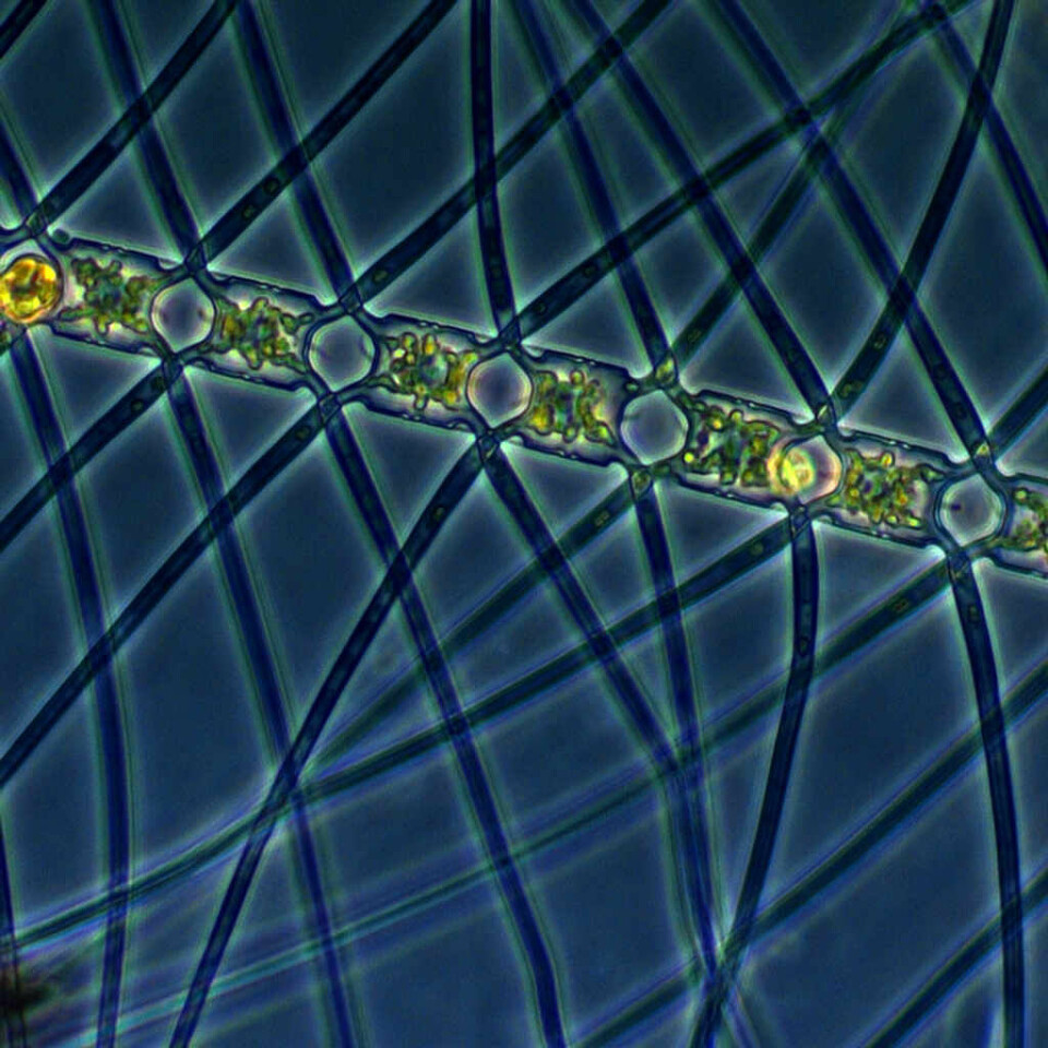 Planktonalgen Chaetoceros atlanticus. (Foto: Marina Montresor, SZN / Alfred Wegener Institute)