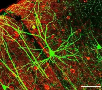 I fosterets hjerne dannes det tusenvis av nerveceller hvert eneste minutt. Ifølge Philippe Grandjean er det minst 200 kjemikalier i bruk i dag som kan skade hjernens utvikling og dermed dannelsen av nevroner. (Foto: Wei-Chung Allen Lee en al., Wikimedia)