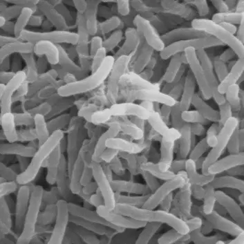 Kolera-bakterier sett gjennom et elektron-mikroskop. (Foto: Wikimedia Commons)