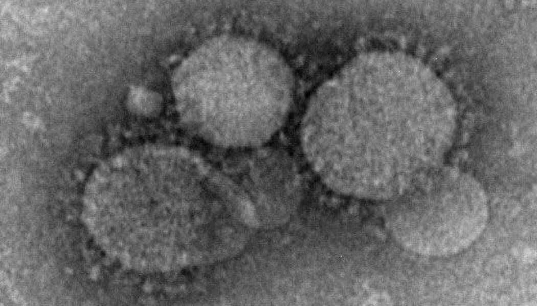 Dette er et mikroskopbilde av koronaviruset som forårsaker MERS hos mennesker. Dette er et annet koronavirus enn det som står bak covid-19.