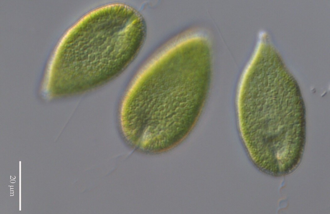 Algen Gonyostomum semen under mikroskop. Disse trives ekstra godt i brune innsjøer. Algen Gonyostomum semen under mikroskop. Disse trives ekstra godt i brune innsjøer.