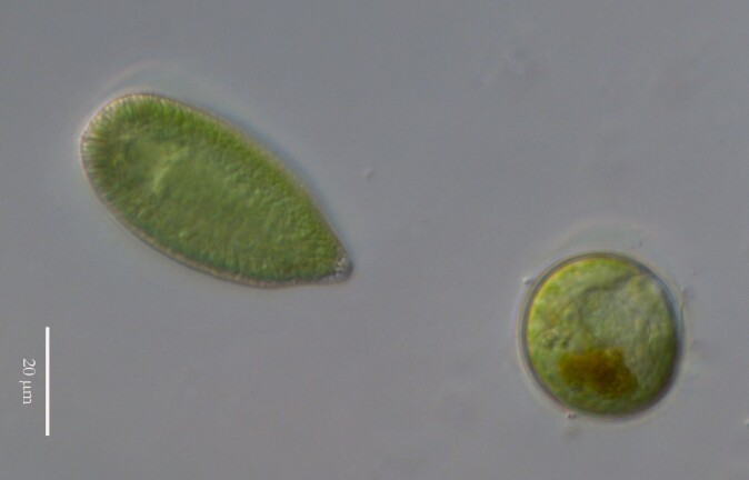 Algen Gonyostomum semen med hvilespore under mikroskop. Algen Gonyostomum semen med hvilespore under mikroskop.