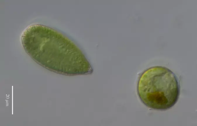 Algen Gonyostomum semen med hvilespore under mikroskop.