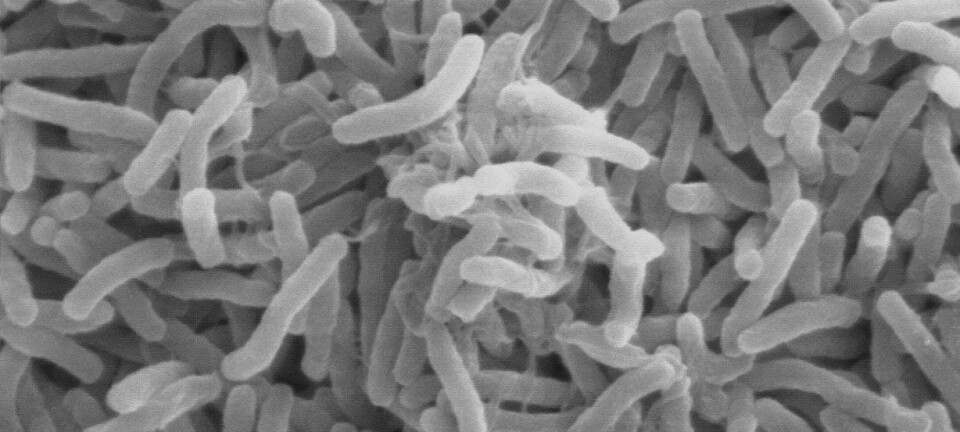 Kolera-bakterier sett gjennom et elektron-mikroskop. Wikimedia Creative Commons