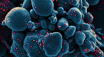 Mikroskopbilder av koronaviruset: Her får du se«den usynlige fienden»