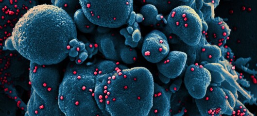 Mikroskopbilder av koronaviruset: Her får du se«den usynlige fienden»