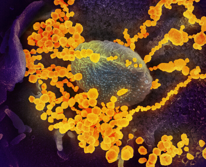 Koronavirus (oransje) bryter ut av en infisert celle i et laboratorium. Viruspartiklene ble opprinnelig isolert fra en amerikansk pasient. Koronavirus (oransje) bryter ut av en infisert celle i et laboratorium. Viruspartiklene ble opprinnelig isolert fra en amerikansk pasient.