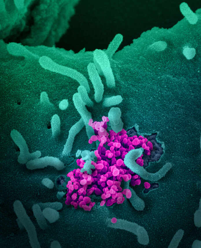 Koronavirus (lilla) bryter ut fra overflaten av en celle som ble dyrket i et laboratorium. Koronavirus (lilla) bryter ut fra overflaten av en celle som ble dyrket i et laboratorium.