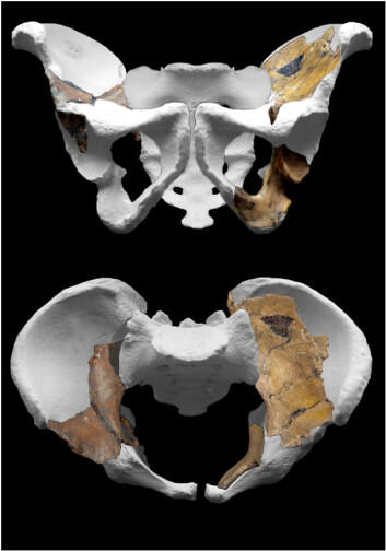 Hofta til Australopithecus sediba. (Foto: Peter Schmid/Lee Berger/University of Witwatersrand) Hofta til Australopithecus sediba. (Foto: Peter Schmid/Lee Berger/University of Witwatersrand)