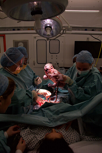 The fetus should not have to pass through a narrow opening in the bony skeleton on the way out. The solution – the Caesarean section. The fetus should not have to pass through a narrow opening in the bony skeleton on the way out. The solution – the Caesarean section.