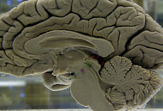 Hvorfor har vi så stor hjerne?