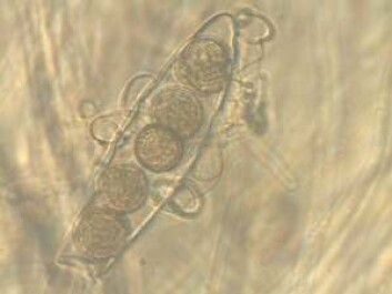 Oogonium med seksuelle formeringsstrukturer (antheridum). (Foto: Even Thoen) Oogonium med seksuelle formeringsstrukturer (antheridum). (Foto: Even Thoen)