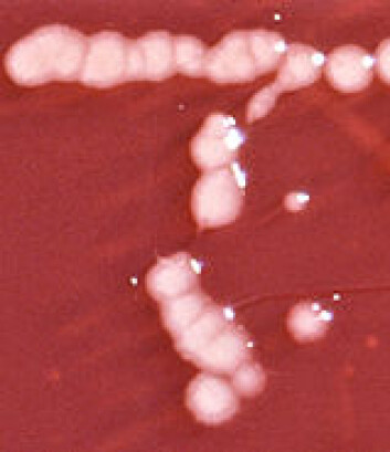 "Pseudomonas-bakterier vokser på næringsrik gelé (agar) i laboratoriet." "Pseudomonas-bakterier vokser på næringsrik gelé (agar) i laboratoriet."