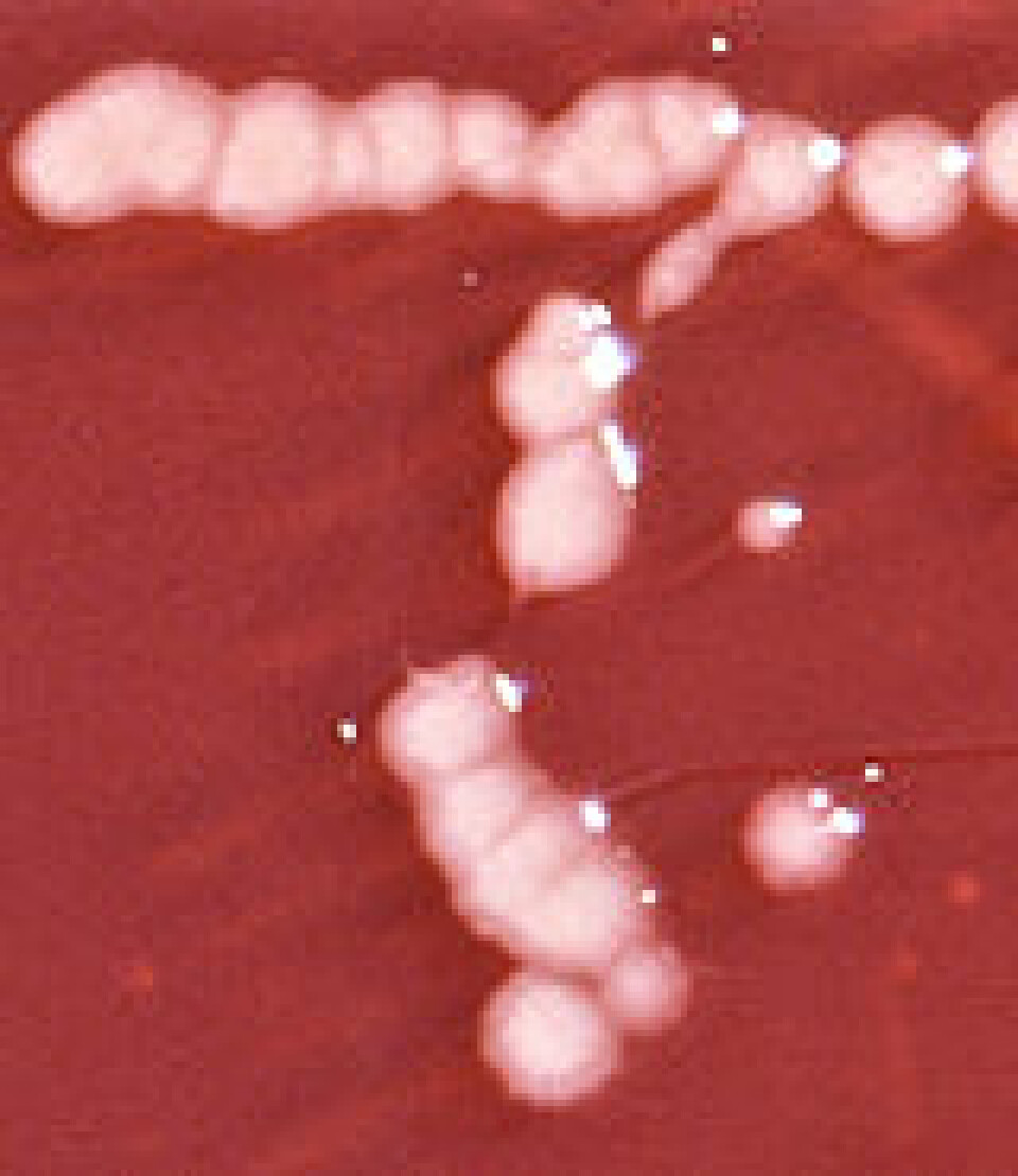 'Pseudomonas-bakterier vokser på næringsrik gelé (agar) i laboratoriet.'