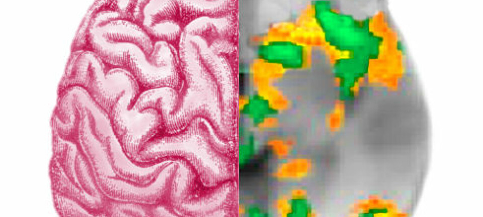 Til venstre: Gammel plansje fra Gutenbergs ensyklopedi. Til høyre: fMRI-skanning av hjerne. Illustrasjonsfotos: Gutenberg Encyclopedia, Creative Commons (t.v), Siri Leknes (t.h)