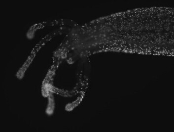 "Klar for mat: Tentaklene og kroppen til Nematostella er dekt med stikkeceller. Dette er sensorceller som hjelper til med fangsten." "Klar for mat: Tentaklene og kroppen til Nematostella er dekt med stikkeceller. Dette er sensorceller som hjelper til med fangsten."