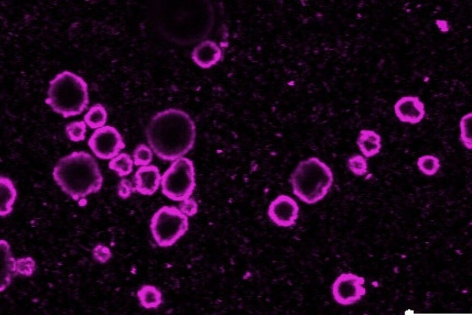 Mikrogassboblar med skal av nanopartiklar kan i kombinasjon med ultralyd gi ein meir målstyrt kreftbehandling i framtida, trur norske forskarar. (Foto: Sintef)