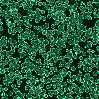 Cyanobakterien er ikke en alge, fordi den ikke har noen cellekjerne. Det visste man imidlertid ikke i gamle dager, da den ble døpt «blågrønnalge».
