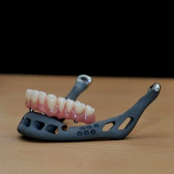 Slik ser en nøyaktig modell av kvinnens kjeveimplantat ut. (Foto: University of Hasselt) Slik ser en nøyaktig modell av kvinnens kjeveimplantat ut. (Foto: University of Hasselt)