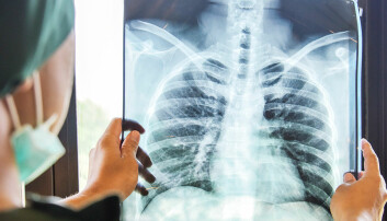 New NTNU method for accurately detecting lung cancer