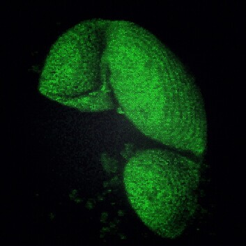 10 000 år gammel furupollen fra innsjø i Trøndelag. (Foto: Science/AAAS) 10 000 år gammel furupollen fra innsjø i Trøndelag. (Foto: Science/AAAS)