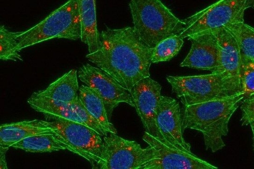 Biletet viser endotelceller som har ete nanopartiklar. Cellene er grøne, cellekjernene er blå, mens dei raude prikkane er nanopartiklar. Endotelceller utgjer ein viktig del av blod-hjerne-barrieren. (Foto: Habib Baghirov, Institutt for fysikk, NTNU)