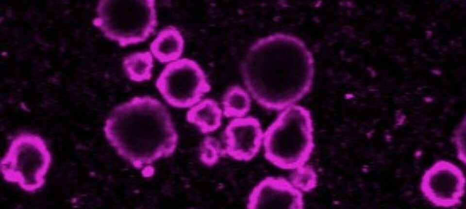 Mikrogassboblar med skal av nanopartiklar kan i kombinasjon med ultralyd gi ein meir målstyrt kreftbehandling i framtida, trur norske forskarar. SINTEF