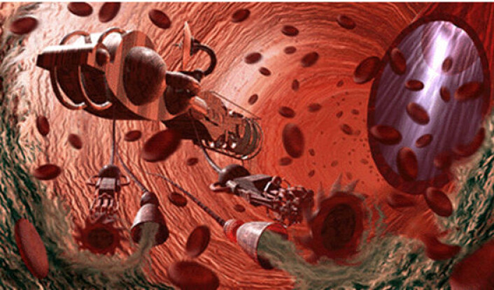 "Nanoroboter i blodomløpet vil kunne bekjempe sykdommer eller holde blodårene åpne." "Nanoroboter i blodomløpet vil kunne bekjempe sykdommer eller holde blodårene åpne."