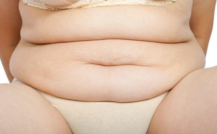 Fedme er et økende problem, og forårsaker blant annet diabetes. (Foto: Colourbox) Fedme er et økende problem, og forårsaker blant annet diabetes. (Foto: Colourbox)