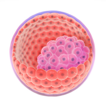 Allerede fem til seks dager etter et egg blir befruktet, har cellene i embryoet begynt å spesialisere seg. De innerste cellene (rosa) blir til fosteret. Mens de ytterste cellene (oransje) blir til blant annet morkaken. Allerede fem til seks dager etter et egg blir befruktet, har cellene i embryoet begynt å spesialisere seg. De innerste cellene (rosa) blir til fosteret. Mens de ytterste cellene (oransje) blir til blant annet morkaken.