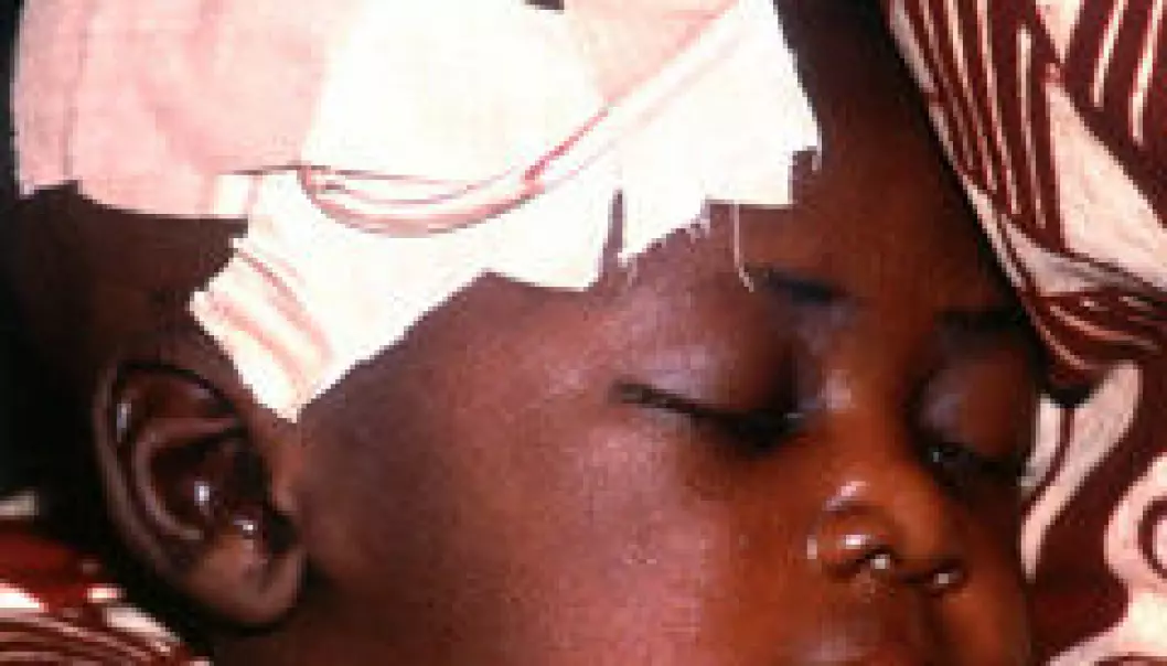 Ny behandling av malaria anbefales