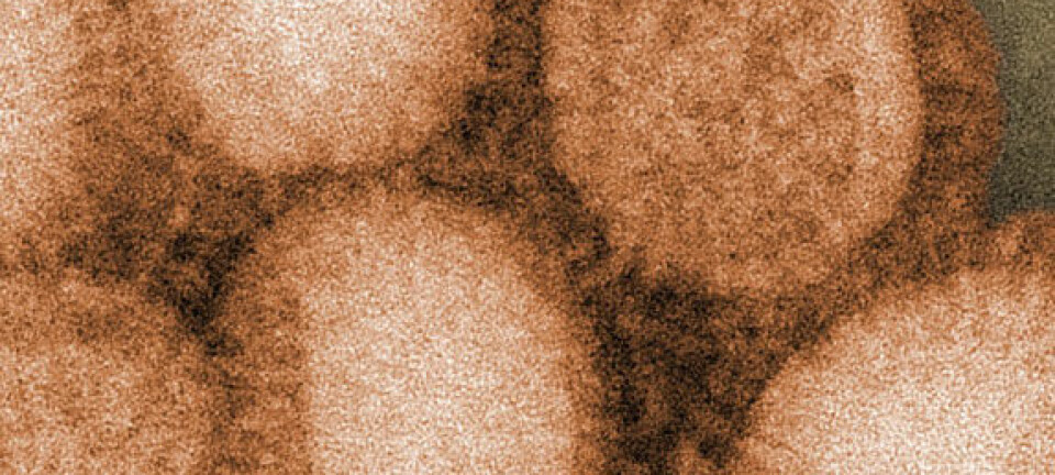 H1N1 (Foto: Wikipedia)