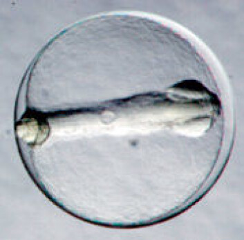 Ti dager gammelt torskeembryo. (Foto: Havforskningsinstituttet) Ti dager gammelt torskeembryo. (Foto: Havforskningsinstituttet)