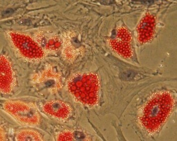 "Disse fettcellene kommer fra stamceller som har blitt differensiert på et laboratorium ved Universitetet i Oslo. Det røde er fettdråpene inni cellene. Fettstamcellene ble hentet fra fettsugingsmateriale, og kan differensieres til flere celletyper i kultur, for eksempel brusk, ben, eller nervelignende celler. (Foto: Philippe Collas)." "Disse fettcellene kommer fra stamceller som har blitt differensiert på et laboratorium ved Universitetet i Oslo. Det røde er fettdråpene inni cellene. Fettstamcellene ble hentet fra fettsugingsmateriale, og kan differensieres til flere celletyper i kultur, for eksempel brusk, ben, eller nervelignende celler. (Foto: Philippe Collas)."