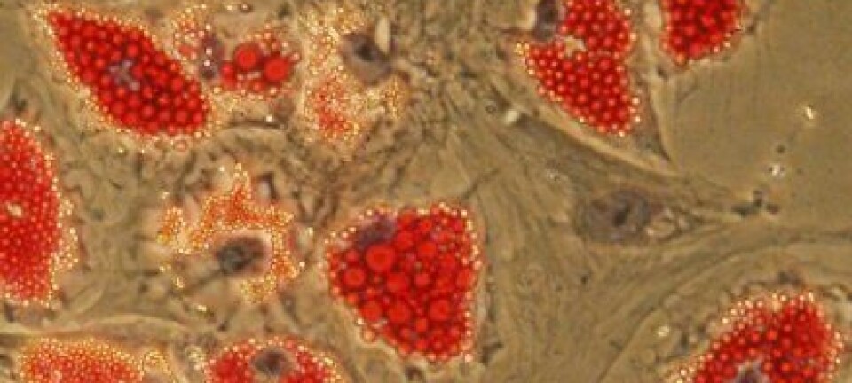 'Disse fettcellene kommer fra stamceller som har blitt differensiert på et laboratorium ved Universitetet i Oslo. Det røde er fettdråpene inni cellene. Fettstamcellene ble hentet fra fettsugingsmateriale, og kan differensieres til flere celletyper i kultur, for eksempel brusk, ben, eller nervelignende celler. (Foto: Philippe Collas).'