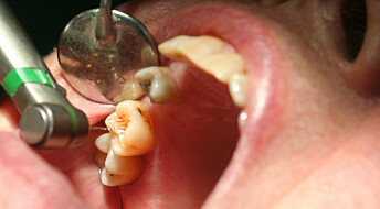 Spør en forsker: Hvorfor leger ikke tennene seg selv?