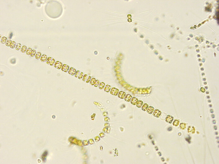 Encellede alger i havet står for produksjonen av omega-3-fettsyrer. (Foto: Bjørnar Sporsheim/Boneslab) Encellede alger i havet står for produksjonen av omega-3-fettsyrer. (Foto: Bjørnar Sporsheim/Boneslab)