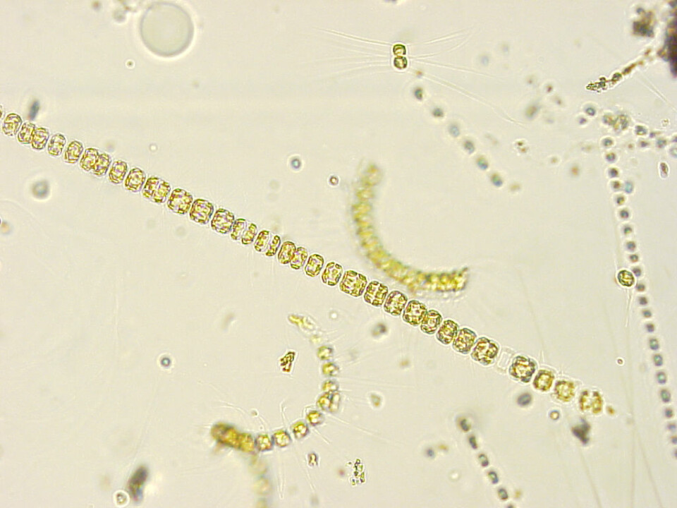 Encellede alger i havet står for produksjonen av omega-3-fettsyrer. (Foto: Bjørnar Sporsheim/Boneslab)