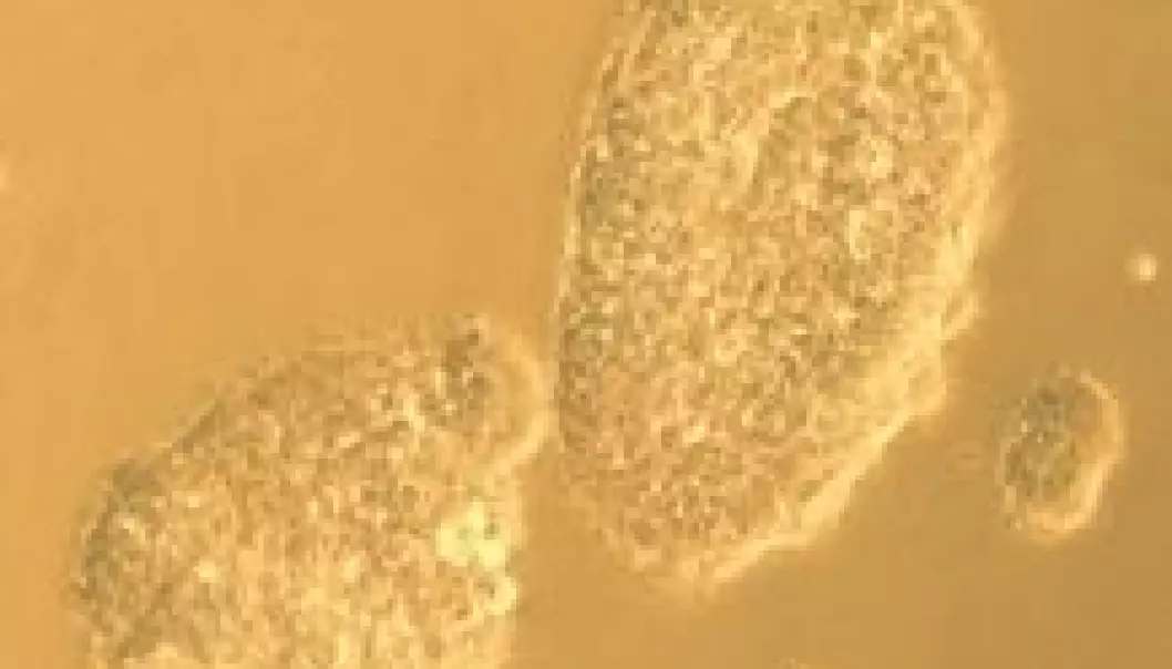 Forskningsåret 2008: Celler med ny identitet