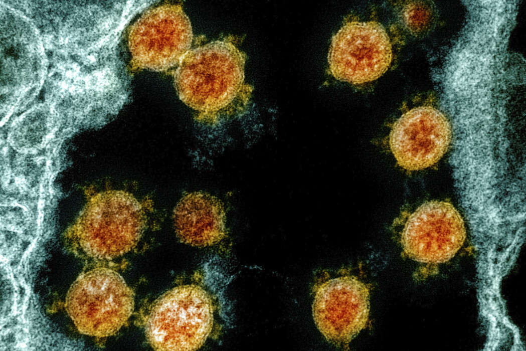 Et bilde av koronavirus tatt med elektronmikroskop. Et bilde av koronavirus tatt med elektronmikroskop.