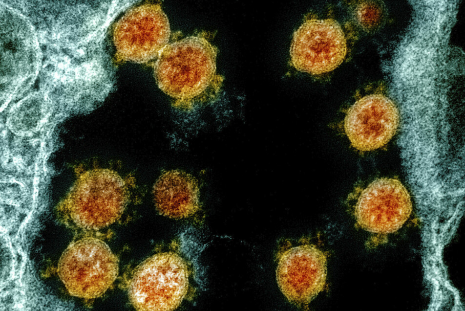 Et bilde av koronavirus tatt med elektronmikroskop.