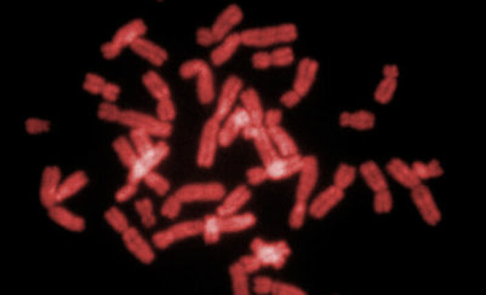 Kromosomer fra menneske. (Foto: Steffen Dietzel, Wikimedia Commons)