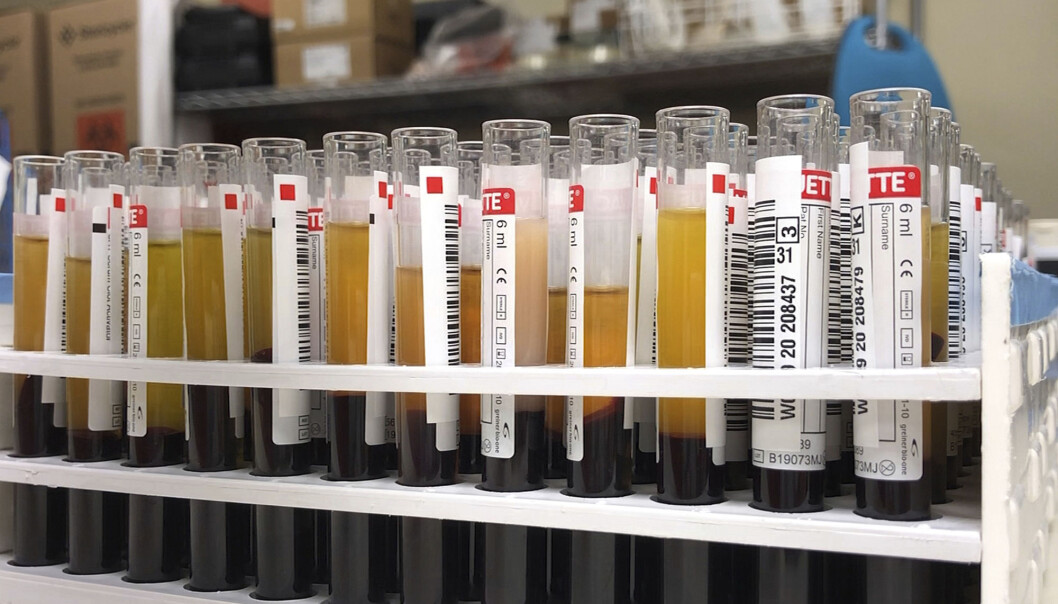Pasienter med covid-19 i blodet kan bli kvitt viruset ved å få blodplasma fra folk som er blitt friske etter å ha hatt sykdommen, viser tidlige resultater fra en studie ved Karolinska Institutet. Her er ampuller fylt med blod fra donorer som er blitt friske fra covid-19 i New York. Pasienter med covid-19 i blodet kan bli kvitt viruset ved å få blodplasma fra folk som er blitt friske etter å ha hatt sykdommen, viser tidlige resultater fra en studie ved Karolinska Institutet. Her er ampuller fylt med blod fra donorer som er blitt friske fra covid-19 i New York.