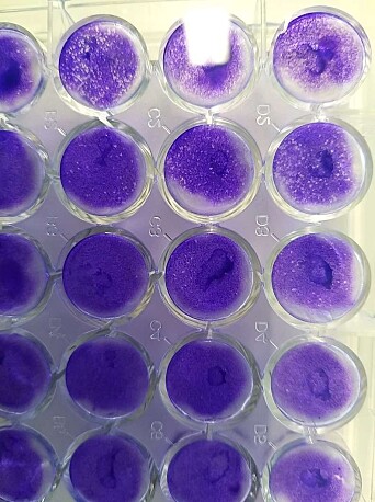 Here’s what the cell cultures look like during the tests. Here’s what the cell cultures look like during the tests.