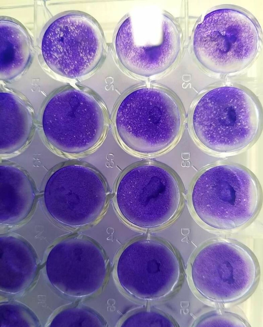 Sånn ser cellekulturene ut.