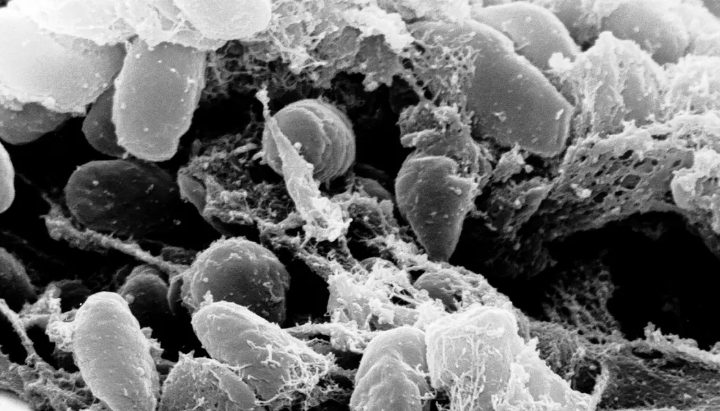 Bakterien Yersinia pestis sto bak svartedauden, men har vært med oss mennesker i minst 5000 år.