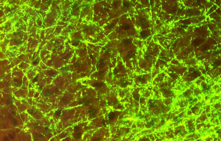 Høyoppløselig figur av tette og sterkt forgrenede mønstrene av aksoner i forbindelser mellom hjernebarkområder i musehjernen. (Foto: (Figur: Allen Institute for Brain Science)) Høyoppløselig figur av tette og sterkt forgrenede mønstrene av aksoner i forbindelser mellom hjernebarkområder i musehjernen. (Foto: (Figur: Allen Institute for Brain Science))